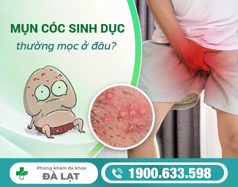 Hình ảnh minh họa